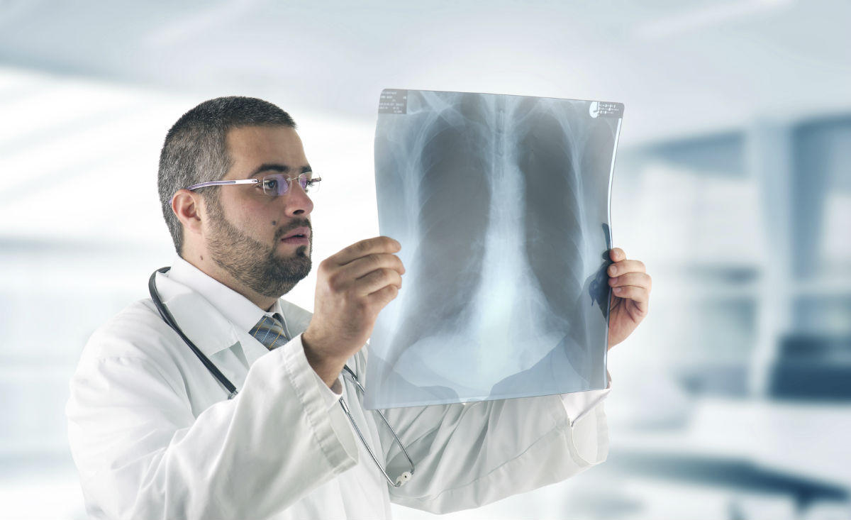 Chest Contusions