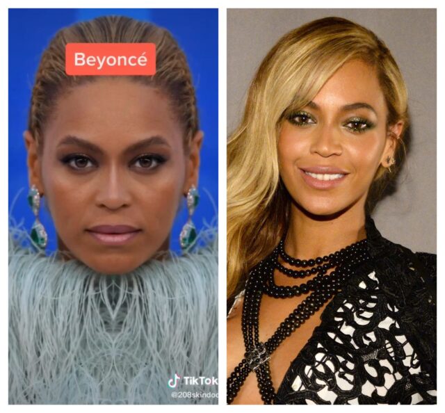 A Dermatologist Proves That Face Symmetry Does Not Equal Beauty - EDM