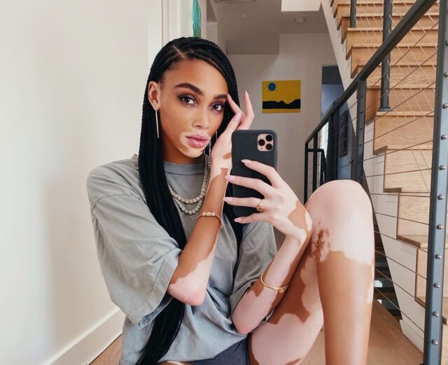 winnieharlow_-