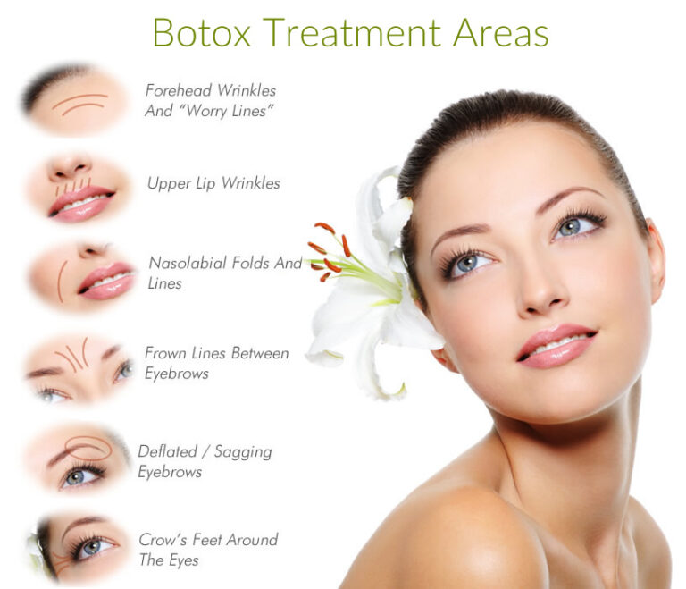 What Areas Can Botox Treat? EDM Chicago