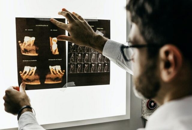 A doctor looking at x-rays