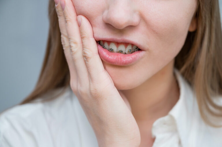 Is It Normal for Your Teeth to Hurt a Lot With Braces? EDM Chicago