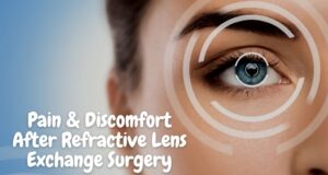 Pain and Discomfort After Refractive Lens Exchange Surgery