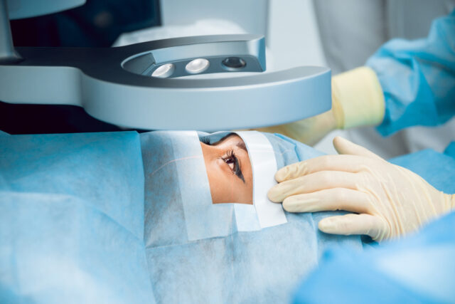 Refractive Lens Exchange Surgery