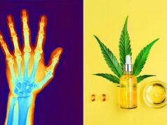 Joint Health Revolution - CBD's Impact on Arthritis Management