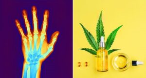 Joint Health Revolution - CBD's Impact on Arthritis Management