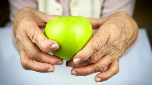 Traditional Arthritis Treatments